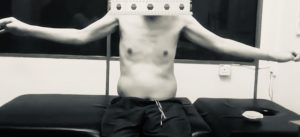 NECK FRACTURE PATIENT PROGRESS REPORT